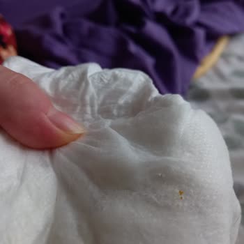 Sleepy Bebek Bezinden Çıkan Saçma Sert Bir Şey.