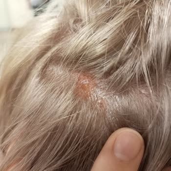 Palette Boya Saç Derimi Yaktı