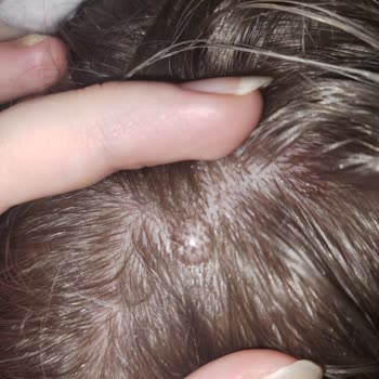 Palette Boya Saç Derimi Yaktı