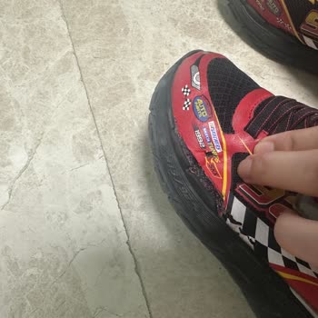 Skechers 10 Gün İçinde Dağılan Spor Ayakkabı Yüzünden Yaşatılan Mağduriyet!