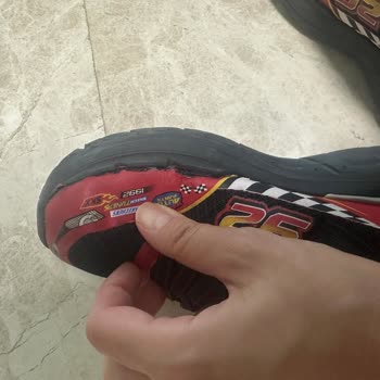 Skechers 10 Gün İçinde Dağılan Spor Ayakkabı Yüzünden Yaşatılan Mağduriyet!