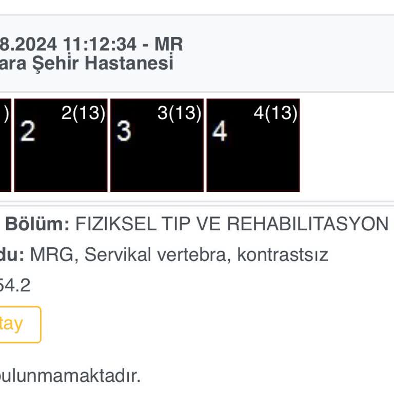 Bilkent Şehir Hastanesi'nde MR Sonuçları İçin Uzun Bekleyiş