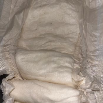 Sleepy Ecologic Bebek Bezi Hayal Kırıklığı Yarattı