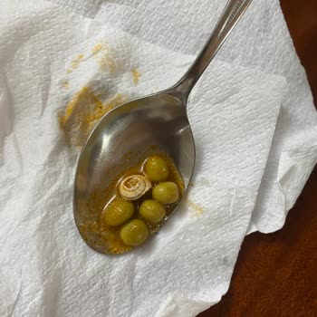 Tat Konserve Ve Salyangoz Faciası