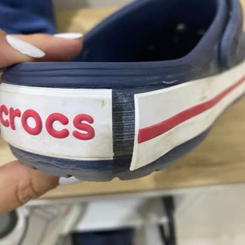 Migros Sattığı Crocs Terliğin Arkasında Durmuyor