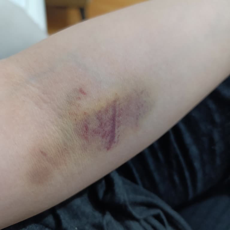 Tekirdağ Çorlu Vega Hastanesi Şikayet Var