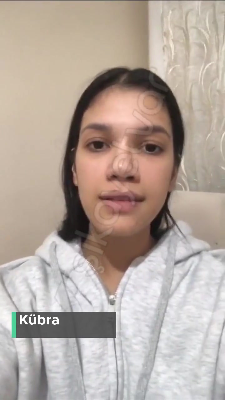 Dr. İbrahim Devecioğlu Eski Burnumda Daha Da Büyük Bir Burnum Var Artık! videonun kapak resmi