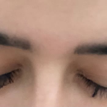 Melek Durak Güzellik Merkezi İşlemler Sonrası Pişmanlığım