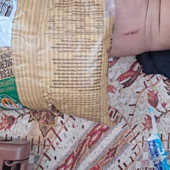 Tarım Kredi Kooperatif Market Böcek Çıktı Yeşil Mercimekten