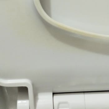 Kale Marka Klozet Kapaklarında Sürekli Sararma Sorunu