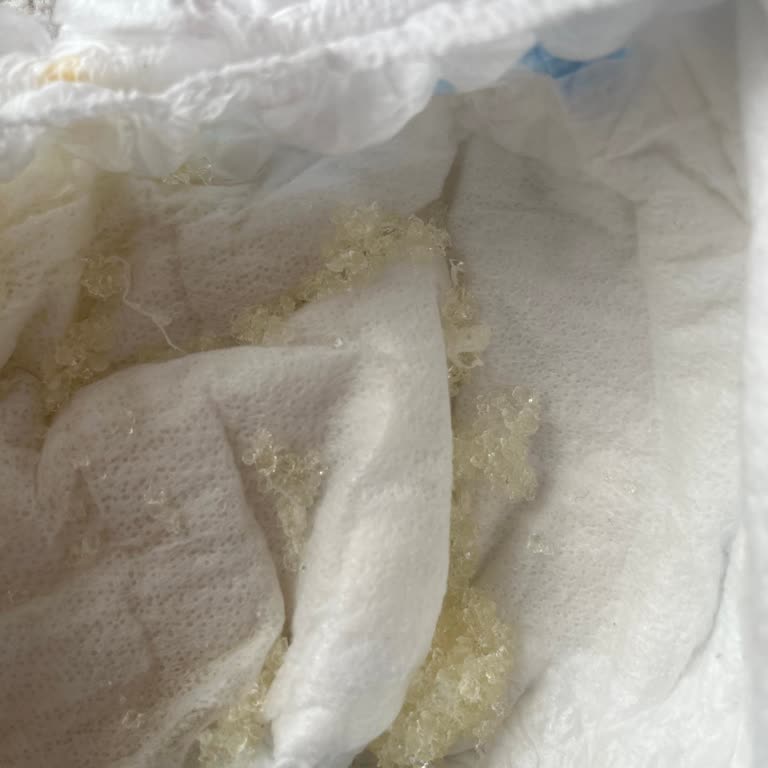 Molfix Kızarıklık Ve Sivilce Yaptı