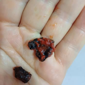 Demko Demirci Konservecilik Domates Salçası İçerisinde Yabancı Madde