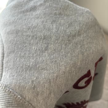 Tommy Hilfiger Sweatshirt'te Aşırı Tüylenme Sorunu!