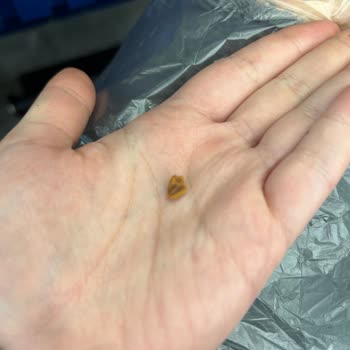 Delly Meyveli Barında Kabuk Çıkması