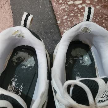 Skechers Ayakkabı Kalitesi Ve Garanti Sorunu