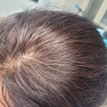 Loreal Saç Boyası Beyaz Kapatmıyor.