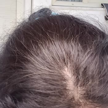 Loreal Saç Boyası Beyaz Kapatmıyor.