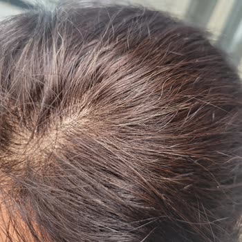 Loreal Saç Boyası Beyaz Kapatmıyor.