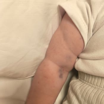 Çakmak Erdem Hastanesi Yapılamayan Tedavi Çektirilen Acı!