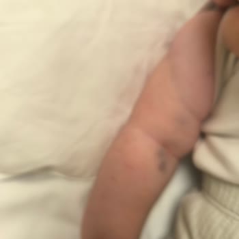 Çakmak Erdem Hastanesi Yapılamayan Tedavi Çektirilen Acı!