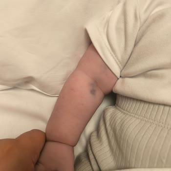 Çakmak Erdem Hastanesi Yapılamayan Tedavi Çektirilen Acı!