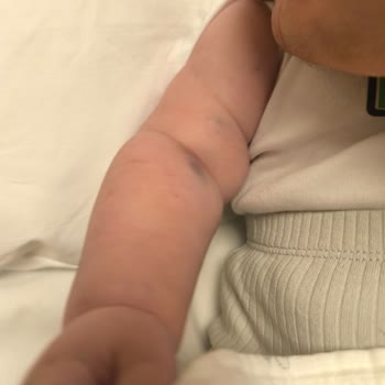 Çakmak Erdem Hastanesi Yapılamayan Tedavi Çektirilen Acı!