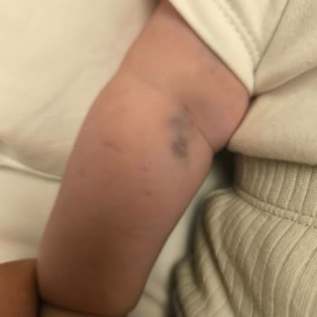 Çakmak Erdem Hastanesi Yapılamayan Tedavi Çektirilen Acı!