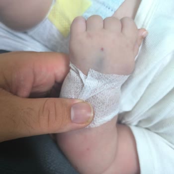 Çakmak Erdem Hastanesi Yapılamayan Tedavi Çektirilen Acı!