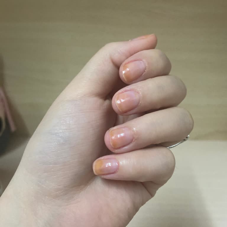 Başkent Kuaför Protez Tırnak Faciası Ve Personeller...