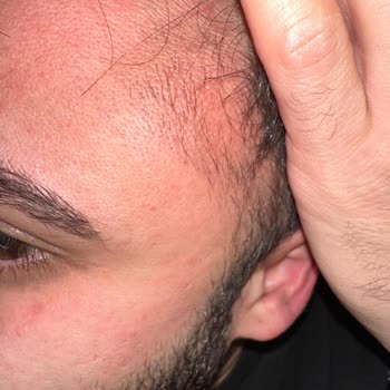 Abdi İbrahim Kimse Ama Hiç Kimse Kullanması!