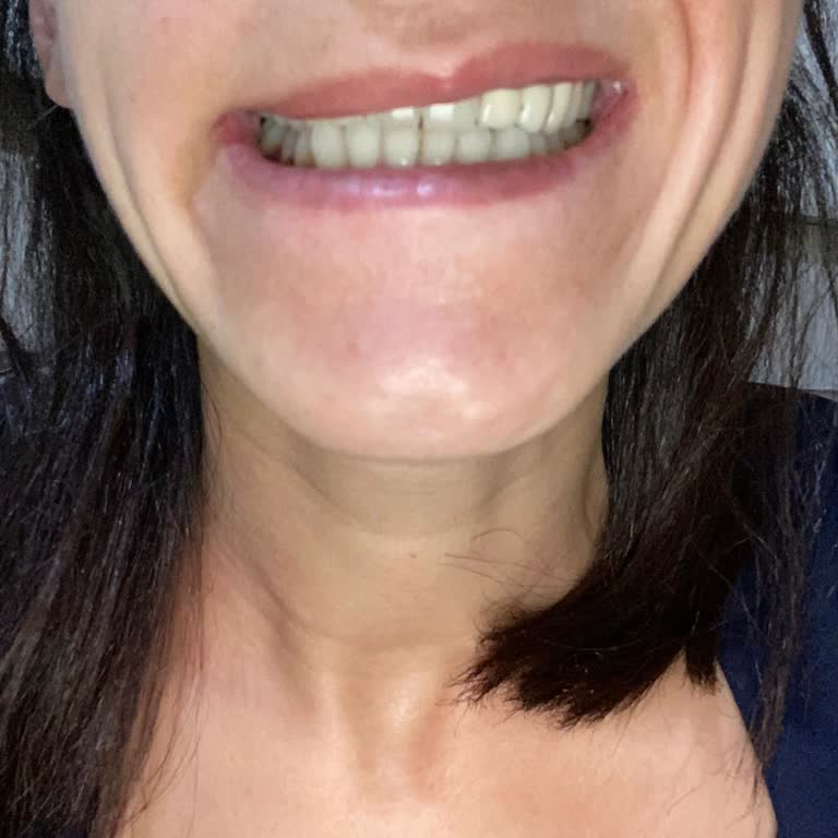 Damla Yaman Estetik Güzellik Merkezinde Yaşadığım Sorunlu Deneyim