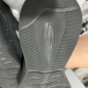 Skechers Ayakkabıda Kalite Sorunu Ve Müşteri Hizmetleri Cevapsızlığı