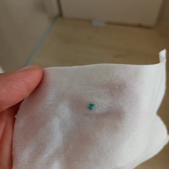 Baby Turco İslak Mendil İçinden Çıkan Cisim