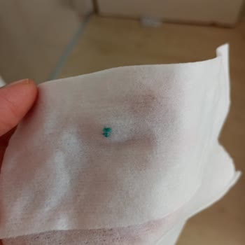 Baby Turco İslak Mendil İçinden Çıkan Cisim