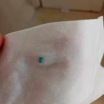 Baby Turco İslak Mendil İçinden Çıkan Cisim