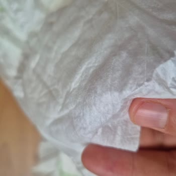 Sleepy Bebek Bezin Arka Kısmında Rahatsız Edici Çıkıntılar Var