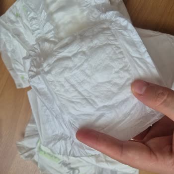 Sleepy Bebek Bezin Arka Kısmında Rahatsız Edici Çıkıntılar Var