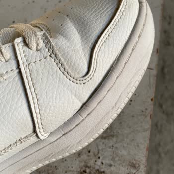 Skechers Ayakkabı Kalitesizliği Ve Müşteri Hizmetleri Sorunu