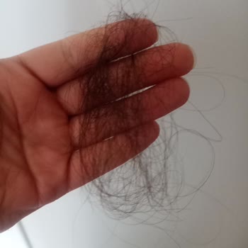 Urban Care Urban Biotin Caffeine Şampuan Saç Dökülmesini Artırdı Ve Kepek Yaptı