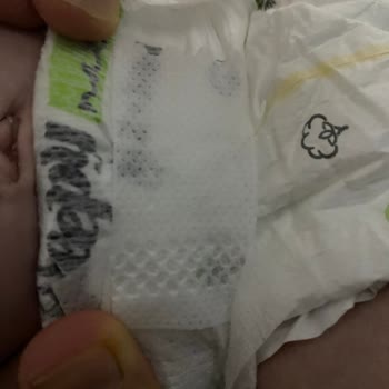 Sleepy Bebek Bezi Patlıyor.