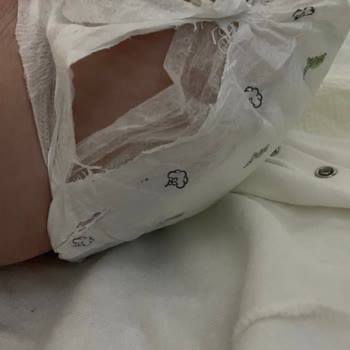 Sleepy Bebek Bezi Patlıyor.