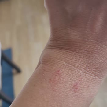 Nomination Alerji Yapan Bileklik Ve İade Sorunu