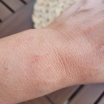 Nomination Alerji Yapan Bileklik Ve İade Sorunu