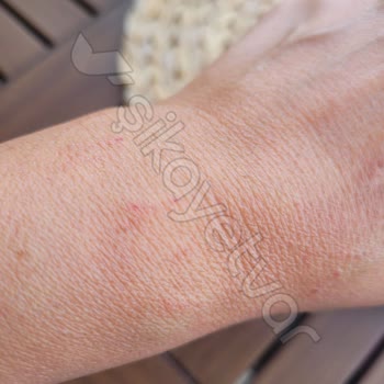 La Vie Nomination Bileklik Alerji Ve Kesik Yaptı