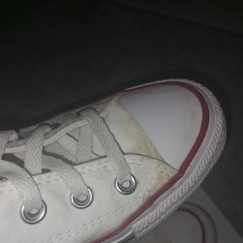 Beyaz Converse Ayakkabılarımın Bez Kısmı Sarardı
