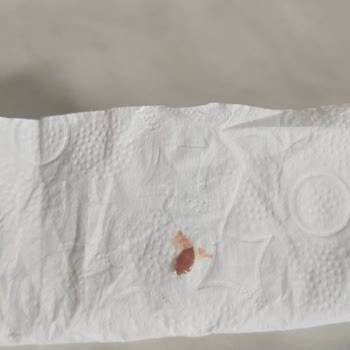 Bellona'dan Aldığım Baza+başlıkta Tahtakurusu Çıktı!