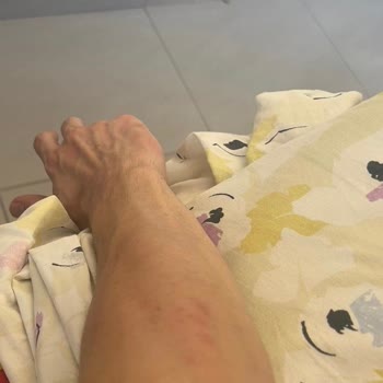 Bellona'dan Aldığım Baza+başlıkta Tahtakurusu Çıktı!