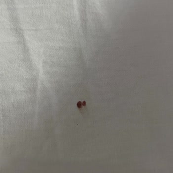 Bellona'dan Aldığım Baza+başlıkta Tahtakurusu Çıktı!