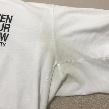 Nivea Deodorant Leke Sorunu