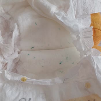 Sleepy Bebek Bezlerin İçinde Ne Olduğu Bilinmeyen Mavi Plastikler